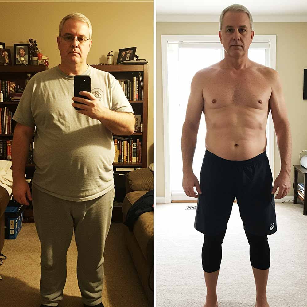 Body Slim Atlanta before and after photo of an older man showing significant medical weight loss