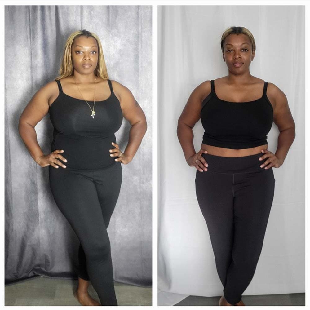 Body Slim Atlanta before and after photo of a woman showing a trimmer midsection